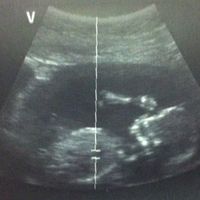 El consultorio de Lita para futuras mamis - 5