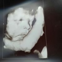 Mamis agosto 2017 - 2