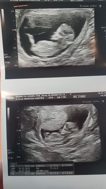 Futuras Mamas Julio 2020. - 1