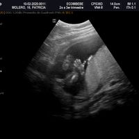 Futuras Mamas Julio 2020. - 1