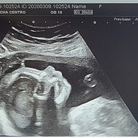 Futuras Mamas Julio 2020. - 1