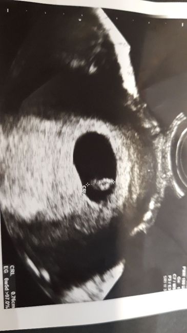 Futuras mamas febrero 2019 1