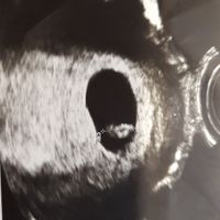 Futuras mamas febrero 2019 - 1