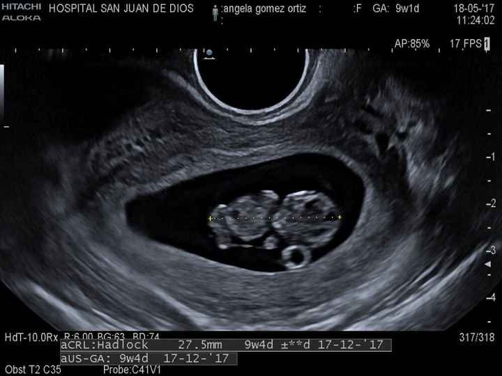 Futuras mamis diciembre 2017 - 1