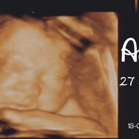 Futuras mamis diciembre 2017 - 1