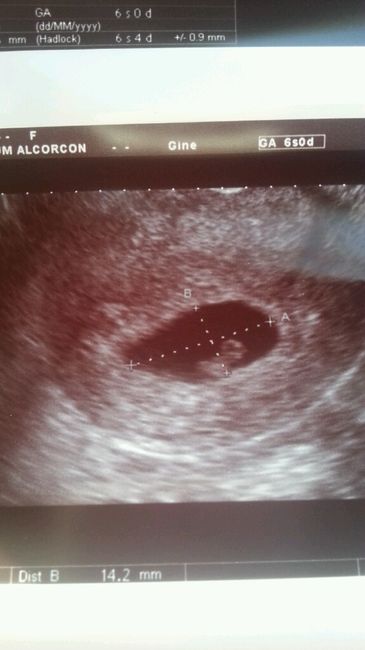 Mamis marzo 2016 - 1