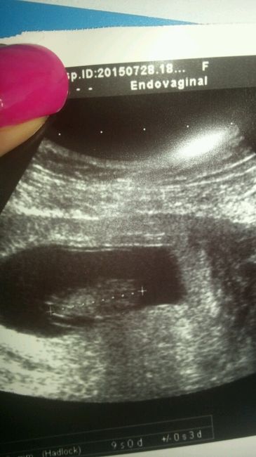 Mamis marzo 2016 - 1
