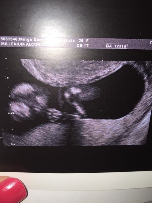 Mamis marzo 2016 - 1