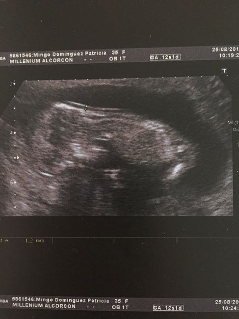 Mamis marzo 2016 - 2