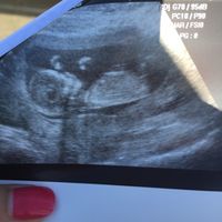 Mamis marzo 2016 - 1