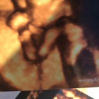 Buscadoras después de uno o varios abortos  - 1