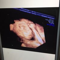 Mamis marzo 2016 - 1