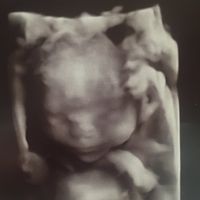 Futuras mamás Diciembre 2018 - 1