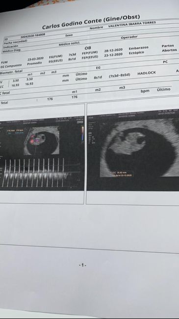 Futuras mamas Diciembre 2020 - 1