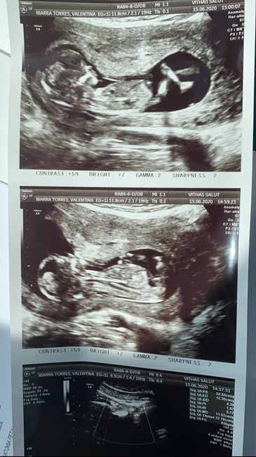 Futuras mamas Diciembre 2020 - 1