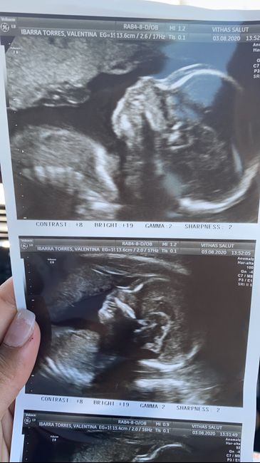 Futuras mamas Diciembre 2020 - 1