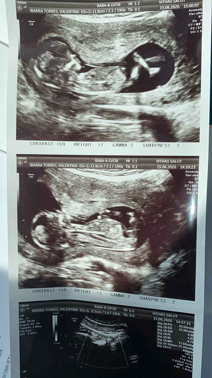 Futuras mamas Diciembre 2020 - 1