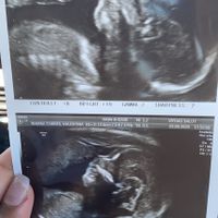 Futuras mamas Diciembre 2020 - 1
