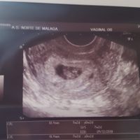 Ayuda con método ramzi: niño o niña? - 2