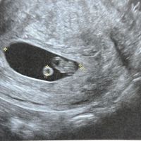 Futuras mamás julio 2021🤰🌹😍😍 - 1
