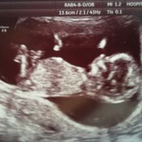 Futuras mamas septiembre 2016 - 1