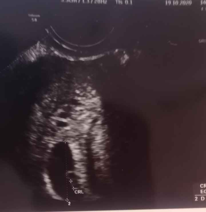 Futuras mamis junio 2021 🤰🏻❤️ oficial - 1