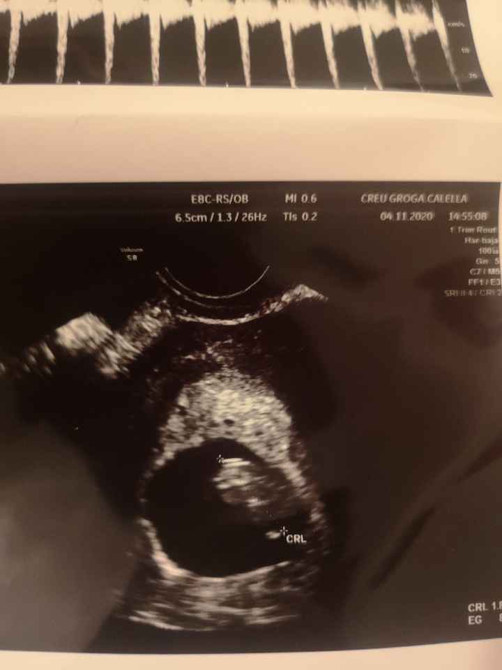 Futuras mamis junio 2021 🤰🏻❤️ oficial - 1