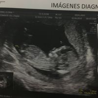 Tubérculo genital niño o niña??? - 1