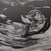 Futuras mamas Diciembre 2020 - 1