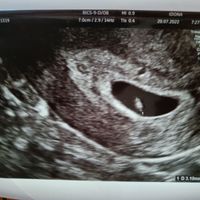 Futuras mamis marzo 2023 - 1