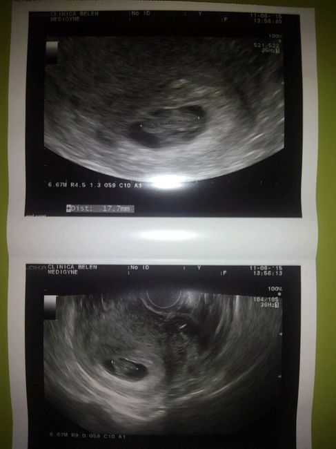 Mamis enero 2016 - 1