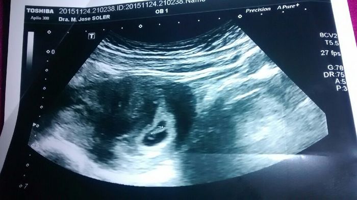 Futuras mamas julio 2016 - 1