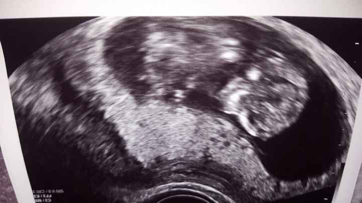 Futuras mamis octubre 2016 - 1