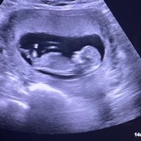 Futuras mamis abril 2025 - 1