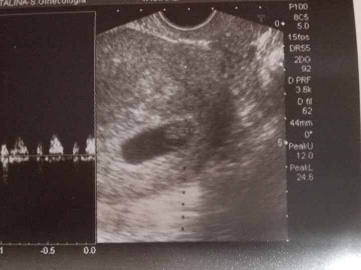 8+1semanas2