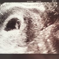 Futuras mamás Noviembre 2018! - 1