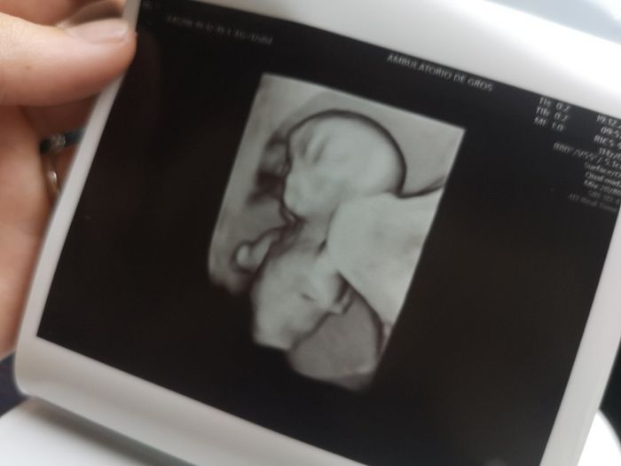 Futuras Mamas Julio 2020. - 1