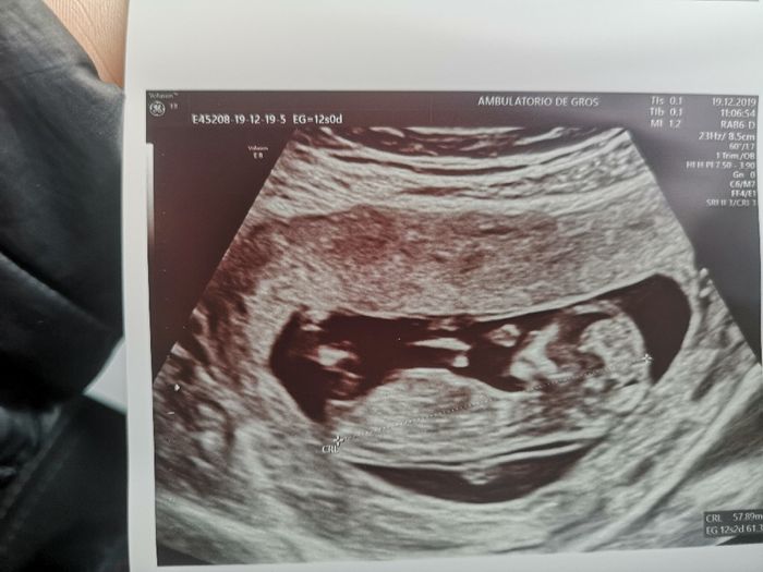 Futuras Mamas Julio 2020. - 2