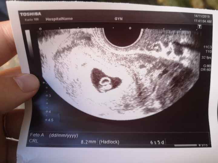 Futuras Mamás Julio 2020 - 1