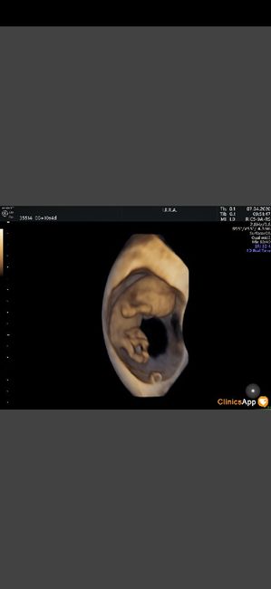 Futuras mamas octubre 2020 - 2