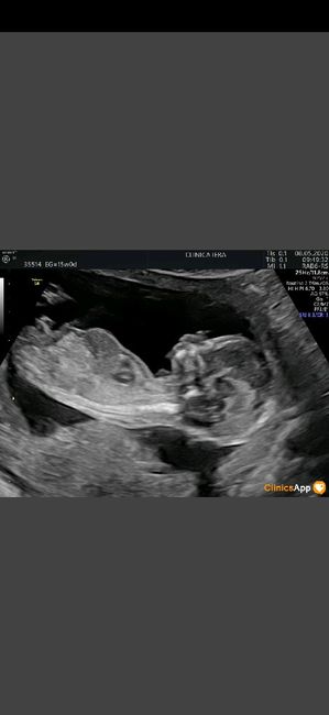 Futuras mamas octubre 2020 - 1