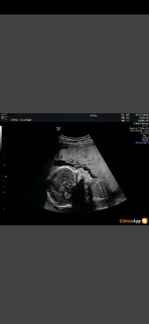 Futuras mamas octubre 2020 - 2
