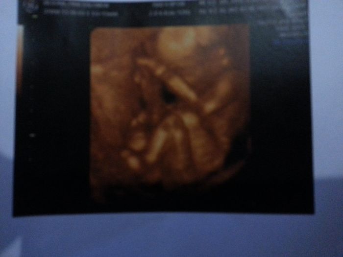 El consultorio de Lita para futuras mamis - 1