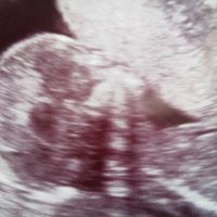 Futuras mamás marzo 2019 - 1