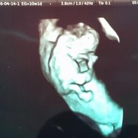 ¡futuras mamis noviembre 2016! - 1