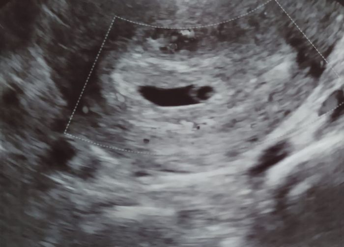 💞 Futuras Mamis marzo 22 🤰🏼 - 1