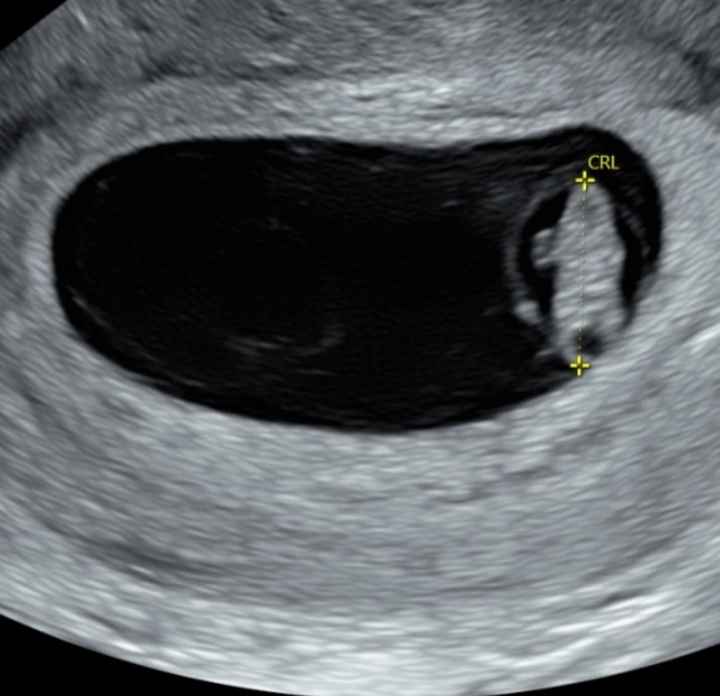 💞 Futuras Mamis marzo 22 🤰🏼 - 1