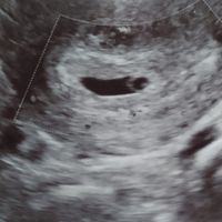 💞 Futuras Mamis marzo 22 🤰🏼 - 1