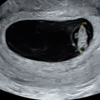 💞 Futuras Mamis marzo 22 🤰🏼 - 1