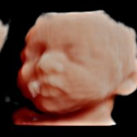 Futuras mamás agosto 2022 - 1